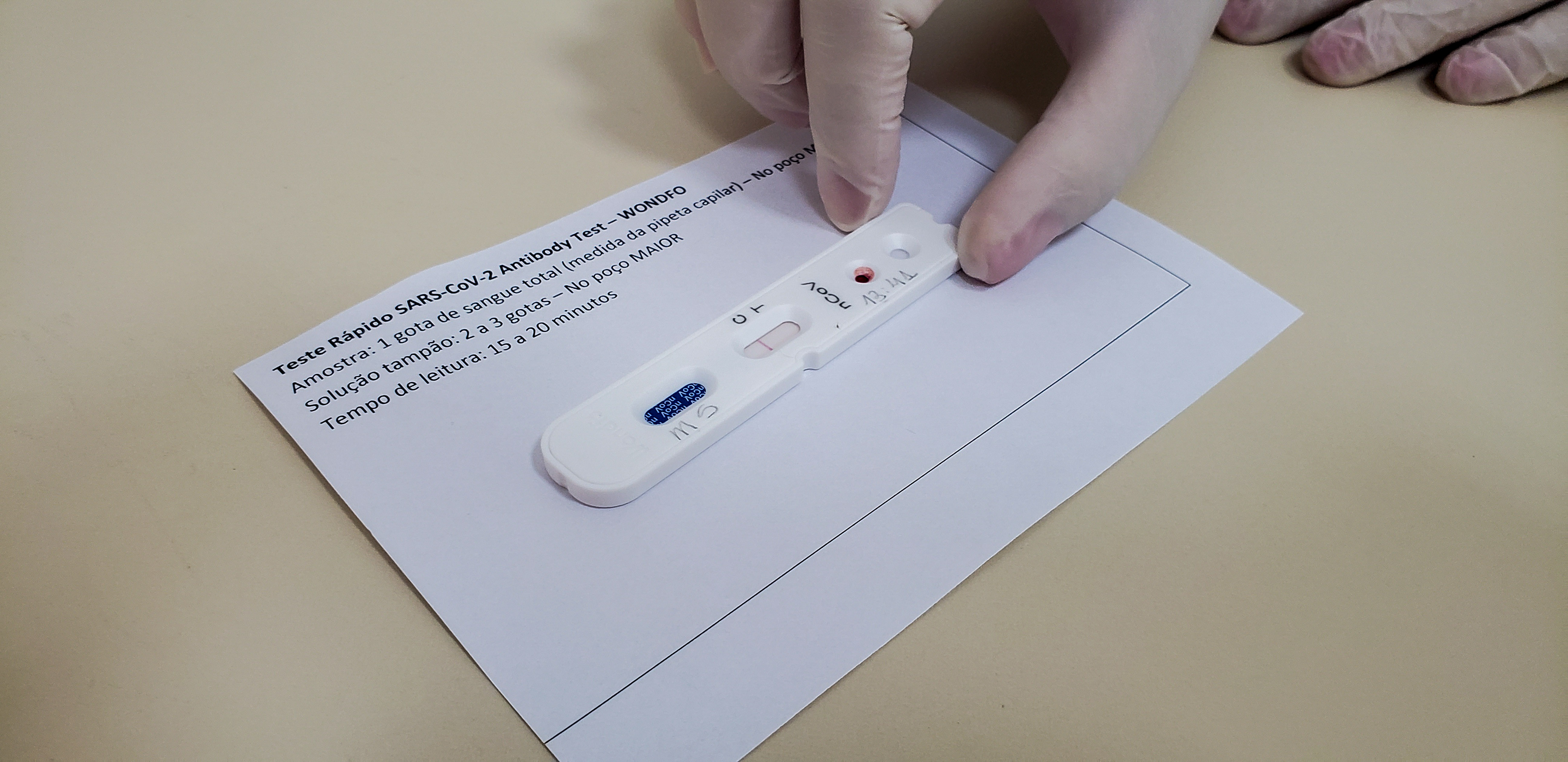 Município começa a realizar testes rápidos em servidores
