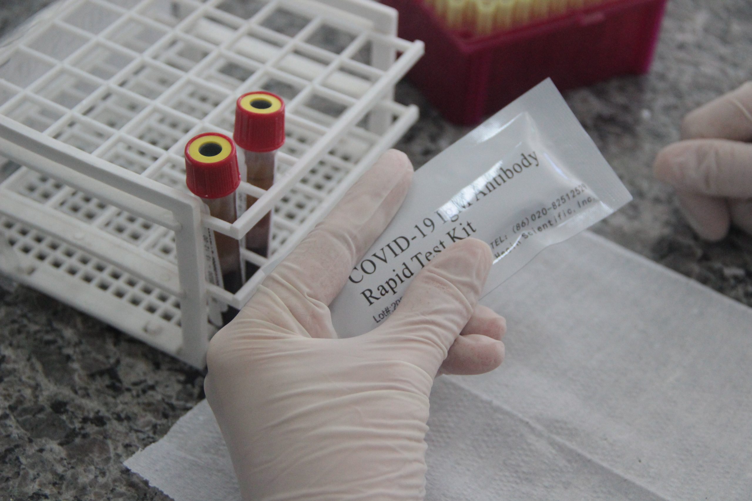 Coronavírus: Itajaí vai realizar testes sorológicos a partir desta quarta-feira