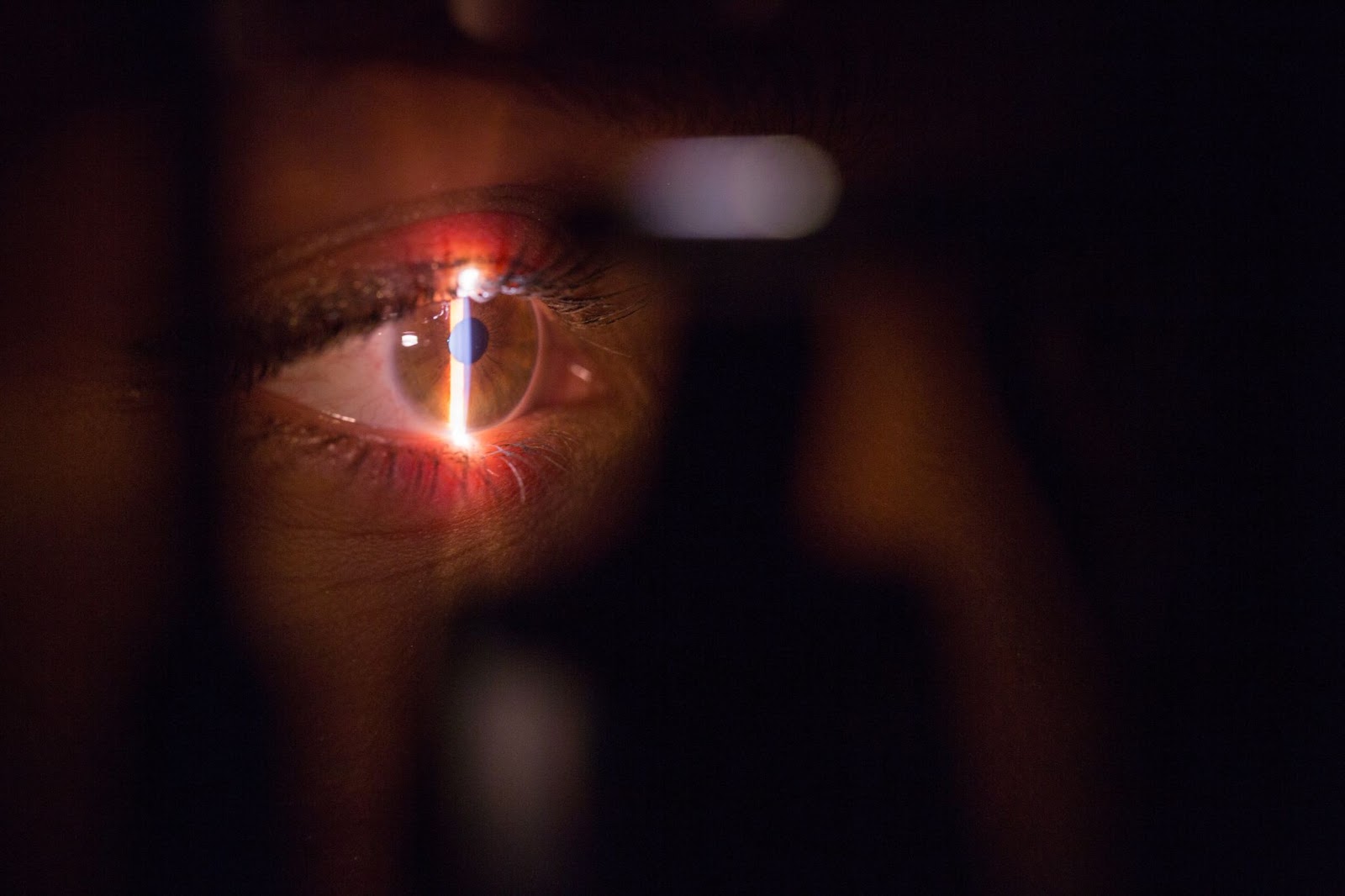 Alterações nos olhos podem apontar para doenças sistêmicas no organismo