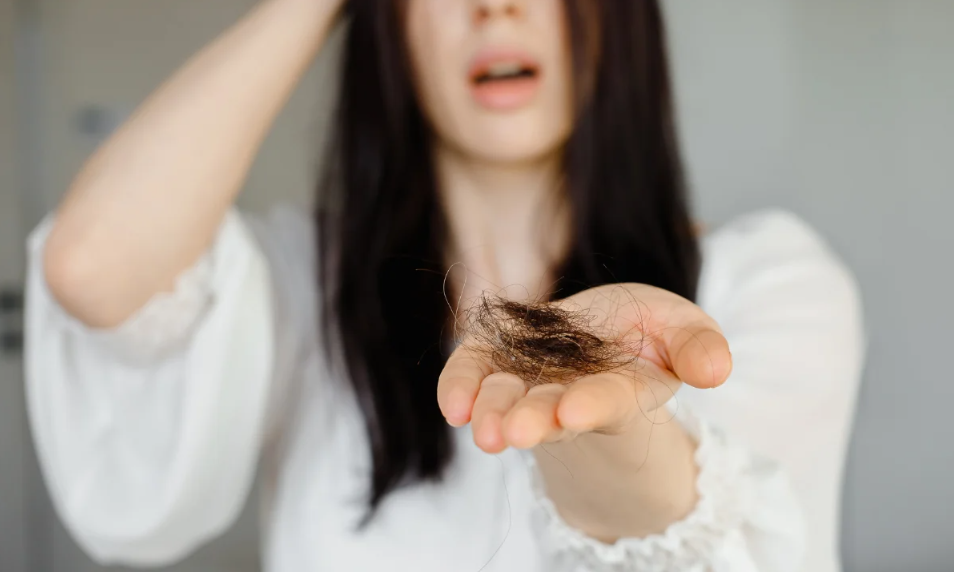Queda de cabelo no outono? Médica explica o que é o eflúvio telógeno sazonal e quando é hora de procurar ajuda
